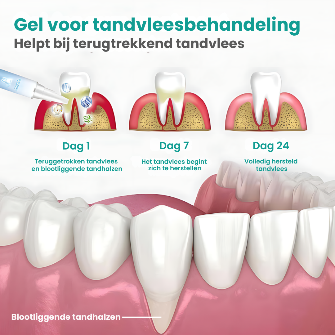 Tandvlees Reparatiegel
